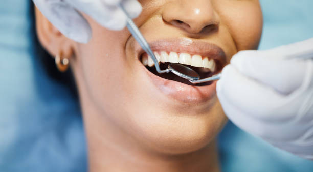 Best After-Hours Dental Trauma Care in Marion, TX
