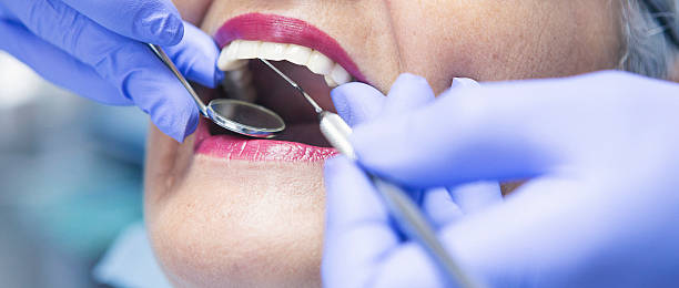 Best Emergency Wisdom Teeth Removal in Marion, TX